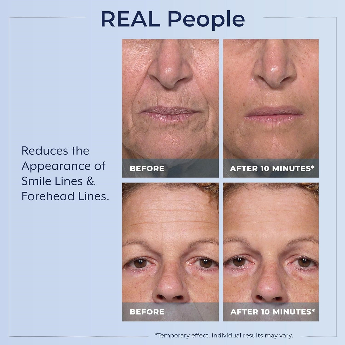 Rapid Reduction Serum - Visibly Reduces Under-Eye Bags & Wrinkles