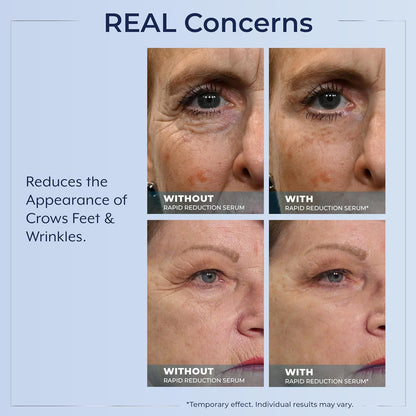 Rapid Reduction Serum - Visibly Reduces Under-Eye Bags & Wrinkles